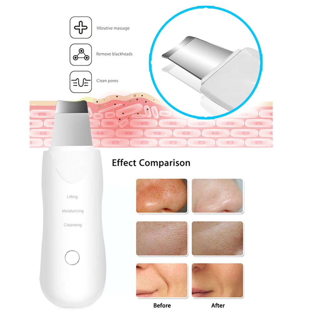 Depurador ultrasónico para la piel, limpiador Facial con vibración profunda, pala, exfoliante, removedor de cabeza negra, masajeador Facial - Image 12